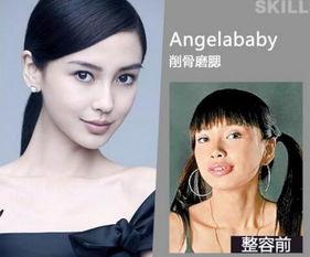 長沙整容爆料案件最新,揭開醫(yī)美行業(yè)潛規(guī)則與維權(quán)困境